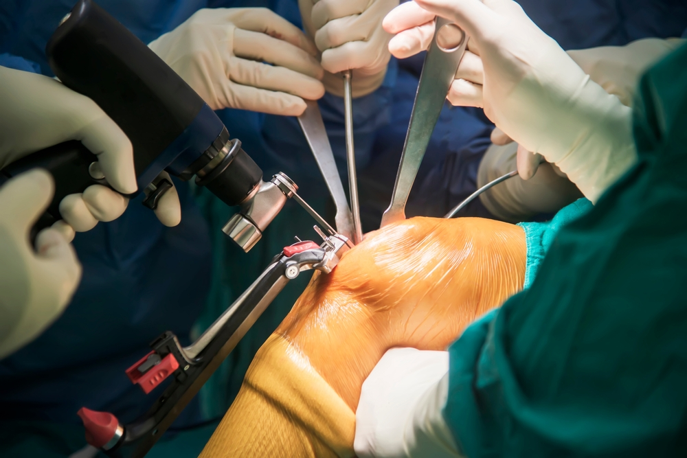 Osteotomy Surgery Cost